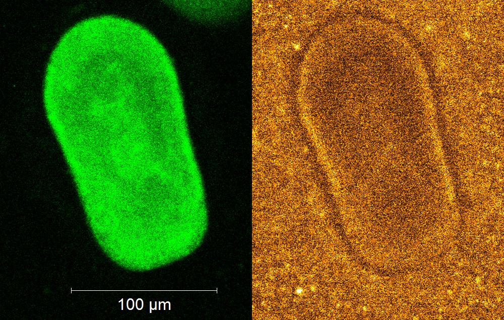 Confocal images of a Day 3 larvae