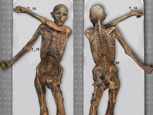 illustration of tattoo placement.