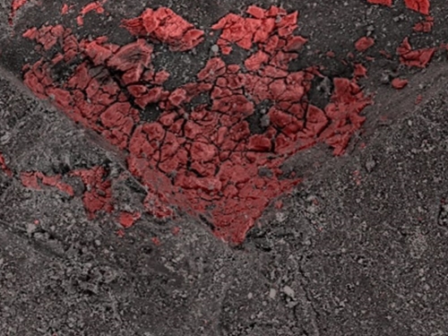Microscopic close-up of gray textured area with red scaling.
