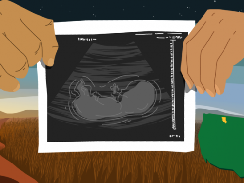 illustration of a sonogram