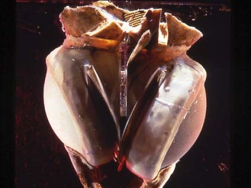 Liotta-Cooley Artificial Heart, 1969