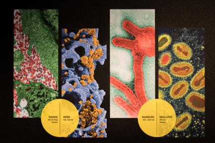 viruses on slide
